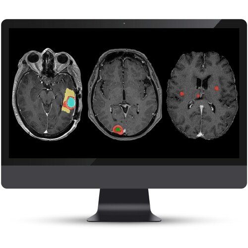 All 3 modules of NeuroQuant® Brain Tumor on a monitor.