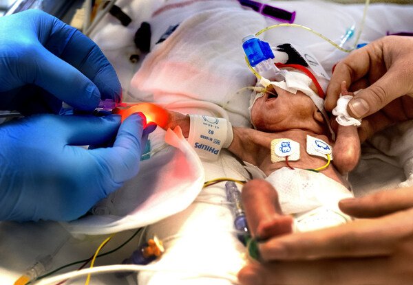   Photo Credit: Klaas Jan van der Weij (photographer) at Wilhelmina Children’s Hospital of the University Medical Centre of Utrecht, Netherlands