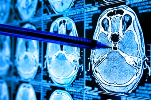 image credit- shutterstock